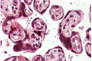 Placenta, Human: Formalin-Fixed, Paraffin-Embedded (FFPE) (USP2 Antikörper  (C-Term))