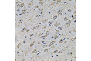 Immunohistochemistry of paraffin-embedded rat brain using ATP2A2 Antibody. (ATP2A2 Antikörper)