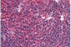 Human Tonsil: Formalin-Fixed, Paraffin-Embedded (FFPE) (BIRC3 Antikörper  (AA 314-508))