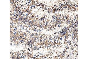 IHC analysis of IMPDH1 using anti-IMPDH1 antibody (ABIN7599864). (IMPDH1 Antikörper  (AA 123-500))