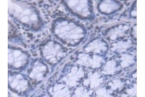 DAB staining on IHC-P; Samples: Mouse Colon Tissue (HNRNPA1 Antikörper  (AA 2-320))