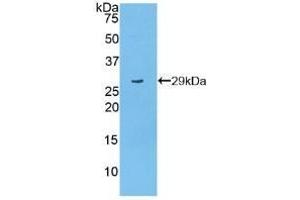 Detection of Recombinant PARP, Mouse using Polyclonal Antibody to Poly ADP Ribose Polymerase (PARP) (PARP1 Antikörper  (AA 661-881))