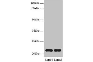 Western blot All lanes: CXXC4antibody at 3. (CXXC4 Antikörper  (AA 1-198))