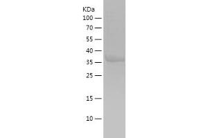 Western Blotting (WB) image for ADAM Metallopeptidase Domain 17 (ADAM17) (AA 752-824) protein (His-IF2DI Tag) (ABIN7121690)