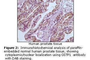 Image no. 1 for anti-Glutathione S-Transferase pi 1 (GSTP1) antibody (ABIN207627) (GSTP1 Antikörper)