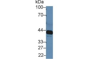 Western blot analysis of Rat Serum, using Rat IL6R Antibody (5 µg/ml) and HRP-conjugated Goat Anti-Rabbit antibody ( (IL-6 Receptor Antikörper  (AA 214-348))