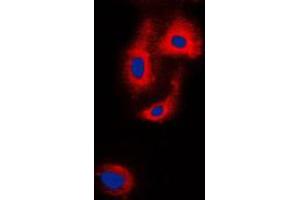 Immunofluorescent analysis of VASP staining in HepG2 cells.