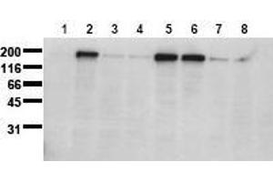 Western Blotting (WB) image for anti-Epidermal Growth Factor Receptor (EGFR) (pSer1071) antibody (ABIN126767) (EGFR Antikörper  (pSer1071))
