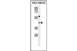 Western blot analysis of ABHD9 Antibody (C-term) in MDA-MB435 cell line lysates (35ug/lane). (ABHD9 Antikörper  (C-Term))