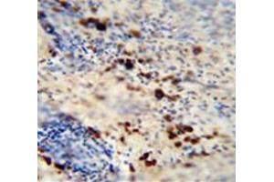 Immunohistochemistry (Paraffin-embedded Sections) (IHC (p)) image for anti-Late Cornified Envelope 1A (LCE1A) (AA 57-87), (C-Term) antibody (ABIN953146)