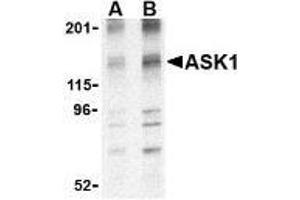 Western blot analysis of ASK1 in 3T3 cell lysate with AP30087PU-N ASK1 antibody at (A) 1 and (B) 2 μg/ml. (ASK1 Antikörper  (N-Term))