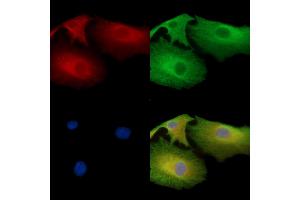NCE2 Antibody staining A549 cells by IF/ICC. (UBE2F Antikörper)