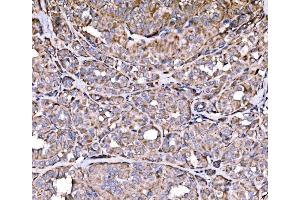 IHC analysis of RPL17 using anti-RPL17 antibody (ABIN7601639). (RPL17 Antikörper  (AA 40-167))