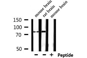 Western blot analysis of extracts from mouse brain,rat brain, using Mitofusin Antibody.