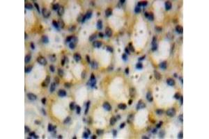 Used in DAB staining on fromalin fixed paraffin-embedded Kidney tissue (Dymeclin Antikörper  (AA 546-669))