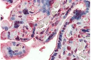 Human Placenta: Formalin-Fixed, Paraffin-Embedded (FFPE) (GAPDH Antikörper  (AA 9-323))