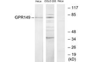 Western blot analysis of extracts from HeLa/COLO205 cells, using GPR149 Antibody. (GPR149 Antikörper  (AA 451-500))