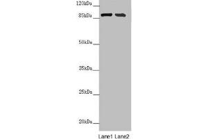 Western blot All lanes: CEP95 antibody at 6. (CEP95 Antikörper  (AA 582-821))