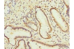 Immunohistochemistry of paraffin-embedded human pancreatic tissue using ABIN7146772 at dilution of 1:100 (CPD Antikörper  (AA 860-1100))