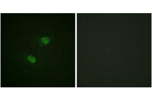 Immunofluorescence analysis of HeLa cells, using CDC16/APC6 (Phospho-Ser560) Antibody. (CDC16 Antikörper  (pSer560))