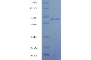 SDS-PAGE (SDS) image for Heterogeneous Nuclear Ribonucleoprotein L (HNRNPL) (AA 89-335), (partial) protein (His-SUMO Tag) (ABIN5709679) (HNRNPL Protein (AA 89-335, partial) (His-SUMO Tag))