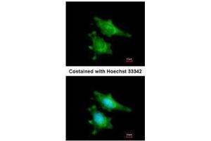 ICC/IF Image Immunofluorescence analysis of methanol-fixed HeLa, using RIP2, antibody at 1:200 dilution. (RIPK2 Antikörper)