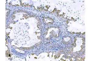 IHC analysis of FOXK1 using anti-FOXK1 antibody (ABIN7600295). (Foxk1 Antikörper  (AA 175-671))
