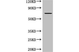 Western Blot Positive WB detected in: MCF-7 whole cell lysate All lanes: GRAMD4 antibody at 5 μg/mL Secondary Goat polyclonal to rabbit IgG at 1/50000 dilution Predicted band size: 67, 11 kDa Observed band size: 67 kDa (GRAMD4 Antikörper  (AA 23-161))