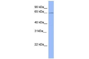 WB Suggested Anti-METTL3 Antibody Titration:  0. (METTL3 Antikörper  (Middle Region))