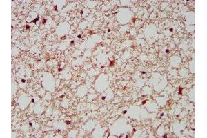 Immunohistochemistry (IHC) image for anti-Aminoacyl tRNA Synthetase Complex-Interacting Multifunctional Protein 1 (AIMP1) (AA 25-180) antibody (ABIN7143995)