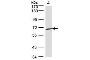 WB Image Sample(30 μg of whole cell lysate) A:MOLT4, 7. (GGT1 Antikörper)