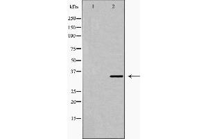 Western blot analysis of Fra 2 expression in LOVO cell extract. (FOSL2 Antikörper  (C-Term))