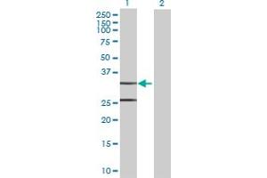 Western Blot analysis of CCDC44 expression in transfected 293T cell line by CCDC44 MaxPab polyclonal antibody. (TACO1 Antikörper  (AA 1-297))