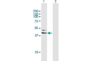 Western Blot analysis of SERPINA5 expression in transfected 293T cell line by SERPINA5 MaxPab polyclonal antibody. (SERPINA5 Antikörper  (AA 1-406))