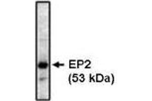 Western blot analysis using EP2 antibody on bovine brain lysate at 1 µg/ml. (PTGER2 Antikörper)