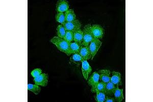IF analysis of Occludin/OCLN using anti-Occludin/OCLN antibody (ABIN7601995). (Occludin Antikörper  (AA 54-270))