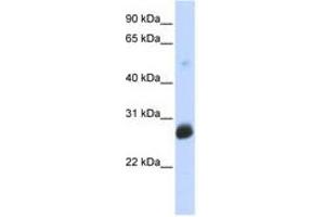 Image no. 1 for anti-Ring Finger Protein 186 (RNF186) (AA 107-156) antibody (ABIN6740809) (RNF186 Antikörper  (AA 107-156))
