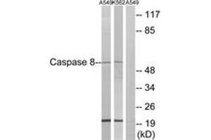 Western blot analysis of extracts from A549/K562, using Caspase 8 (Ab-347) Antibody. (Caspase 8 Antikörper  (AA 313-362))