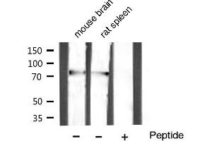 Western blot analysis of extracts of various celllines,using GRP78 Antibody (GRP78 Antikörper)