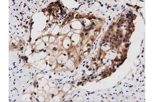 Immunohistochemical staining of paraffin-embedded Human Kidney tissue using anti-PEPD mouse monoclonal antibody. (PEPD Antikörper)