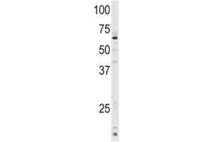 Western Blotting (WB) image for anti-Cytochrome P450, Family 1, Subfamily A, Polypeptide 1 (CYP1A1) (AA 377-405) antibody (ABIN3030670)