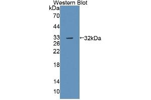 Detection of Recombinant PTPRB, Mouse using Polyclonal Antibody to Protein Tyrosine Phosphatase Receptor Type B (PTPRB) (PTPRB Antikörper  (AA 1214-1463))