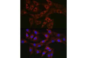 Immunofluorescence analysis of NIH/3T3 cells using A Rabbit pAb (ABIN3023408, ABIN3023409, ABIN3023410 and ABIN6219712) at dilution of 1:50 (40x lens). (ATG4A Antikörper  (AA 289-398))