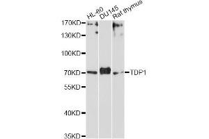 Western blot analysis of extracts of various cell lines, using TDP1 Antibody. (TDP1 Antikörper)