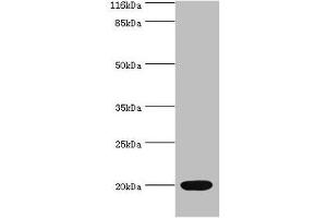 Western blot All lanes: NTS antibody at 2 μg/mL + Mouse small intestine tissue Secondary Goat polyclonal to rabbit IgG at 1/10000 dilution Predicted band size: 20 kDa Observed band size: 20 kDa (Neurotensin Antikörper  (AA 24-143))