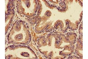 Immunohistochemistry (IHC) image for anti-Proteasome (Prosome, Macropain) Subunit, beta Type, 4 (PSMB4) (AA 46-264) antibody (ABIN7164978)