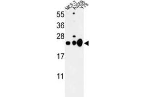 Western Blotting (WB) image for anti-Chromobox Homolog 1 (CBX1) antibody (ABIN3003963) (CBX1 Antikörper)