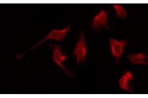 ABIN6276061 staining NIH-3T3 by IF/ICC. (NPY1R Antikörper  (Internal Region))