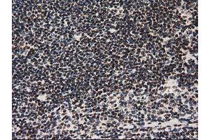 Image no. 7 for anti-Nonhomologous End-Joining Factor 1 (NHEJ1) antibody (ABIN1499729) (NHEJ1 Antikörper)