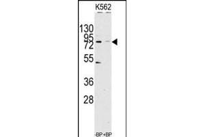 Western blot analysis of anti-JHDM1a/FBXL11 Antibody (C-term) (ABIN1536624 and ABIN2844141) pre-incubated with(right lane) and without(left lane) blocking peptide in Jurkat cell line lysate. (KDM2A Antikörper  (C-Term))